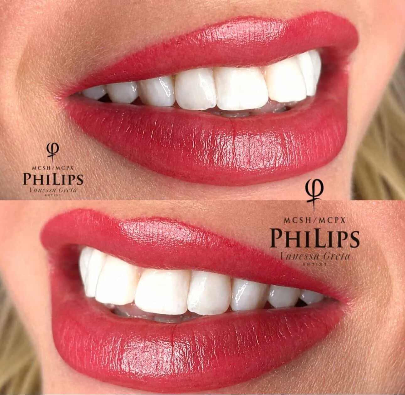Results Lips 1