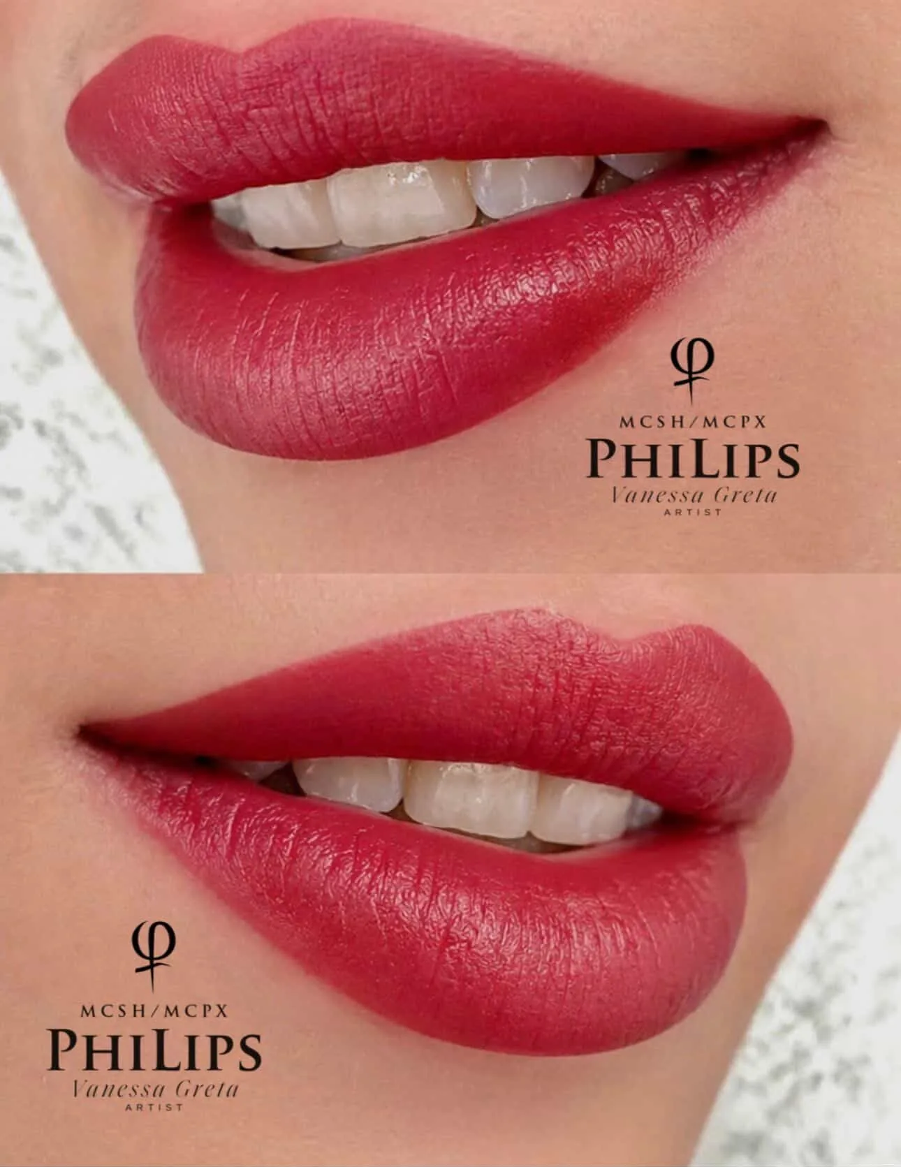 Results Lips 2